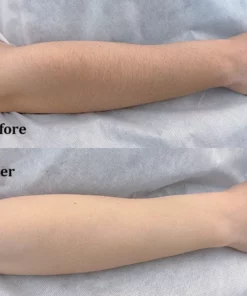 LIMETOW™ Breeze Pure Body Wax