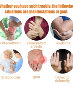 LIMETOW™ New Zealand Bee Venom Professional Treatment Spray