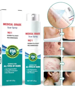 LOVILDS™ Advanced Scar Spray For All Types of Scars