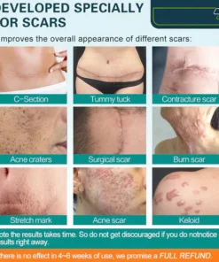 LOVILDS™ Advanced Scar Spray For All Types of Scars