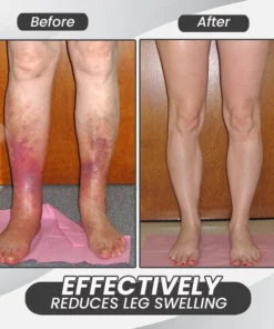 Lenreey™ Magnetic Black Hematite Weight Loss Necklace