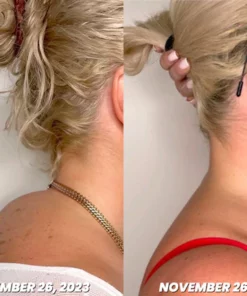 CZTICLE™ Magnetogen Ohrringe für den Lymphfluss