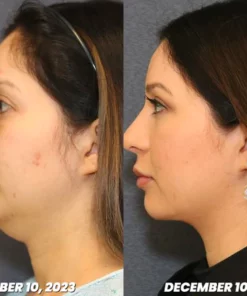 CZTICLE™ Magnetogen Ohrringe für den Lymphfluss