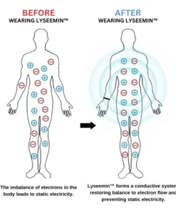 Lyseemin™ Antistatisches Elektrizitätsarmband