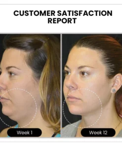 Magnetology Lymphvity Germanium Ohrringe