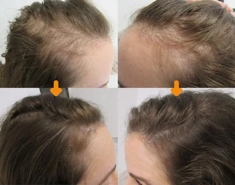 Moonbiffy™ Biotin Premium Hair Growth Serum