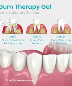 NESLEMY™ Gum Shield Therapy Gel