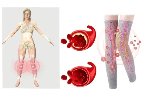 NESLEMY™ Radiofrequency Herbal Thermal Knee Support