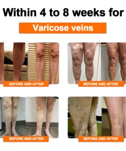 NESLEMY™ Radiofrequency Herbal Thermal Knee Support