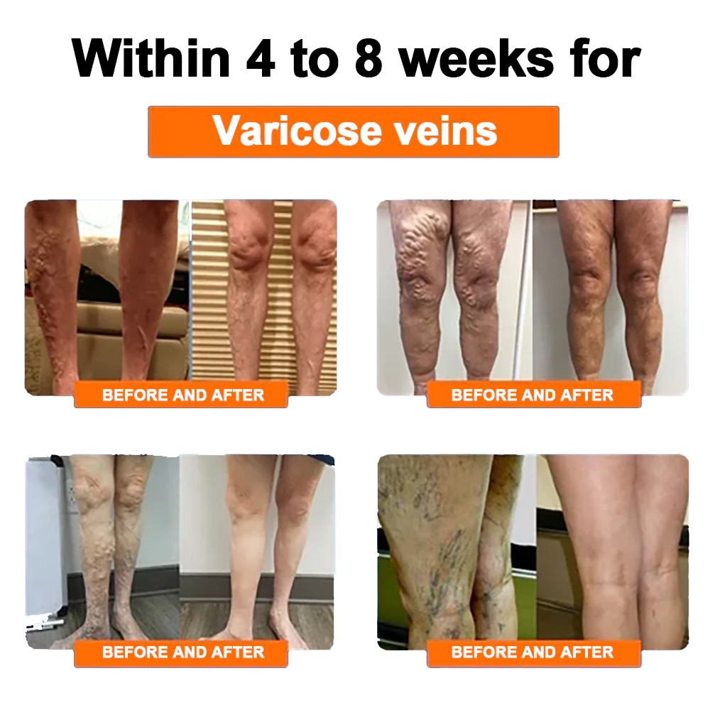 NESLEMY™ Radiofrequency Herbal Thermal Knee Support