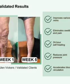 NESLEMY™ Radiofrequency Herbal Thermal Knee Support