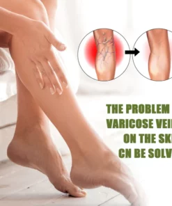 Neslemy™ Varicose Veins Spray