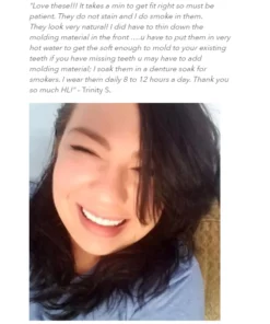 Nurbini™Adjustable Snap-On Dentures