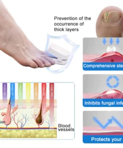 Ourlyard™ Efficient Light Therapy Device for the Treatment of Nail Disorders