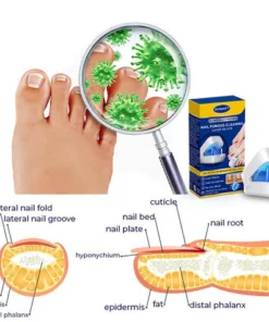 Ourlyard™ Efficient Light Therapy Device for the Treatment of Nail Disorders