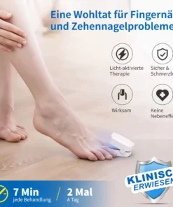 Ourlyard™ Effizientes Lichttherapiegerät zur Behandlung von Nagelerkrankungen