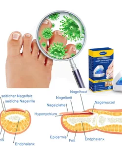 Ourlyard™ Effizientes Lichttherapiegerät zur Behandlung von Nagelerkrankungen