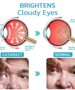 Ourlyard™ FocusHeal Vision Schmiermittel Tränen Augentropfen