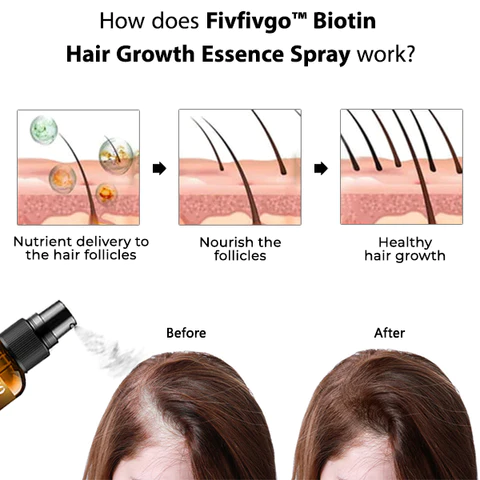 Oveallgo™ Biotin Hair Growth Essence Spray