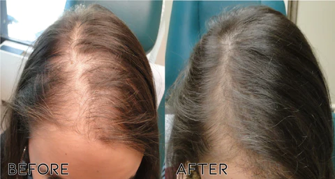 Oveallgo™ Biotin Hair Growth Essence Fesa