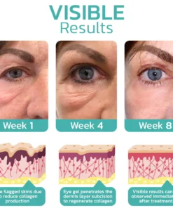 Oveallgo™ CELYN Crema para ojos tensa con péptidos