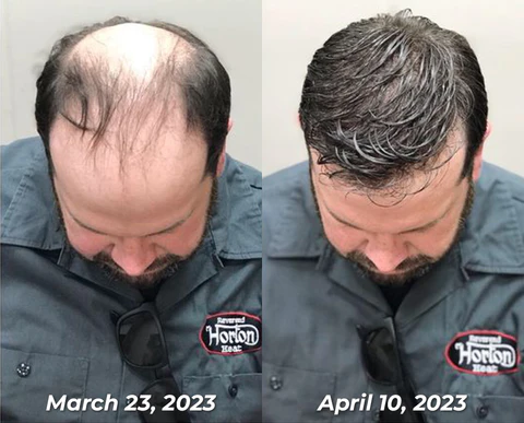 Oveallgo™ Jamaican Black Castor Oil