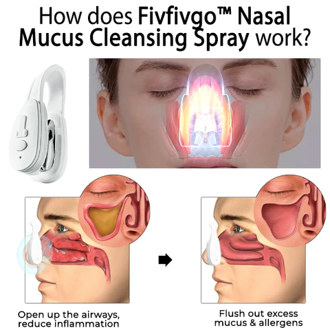 Oveallgo™ Nasal Mucus Cleaning Device