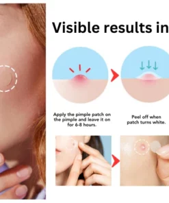Oveallgo™ Nighttime Acne Patch
