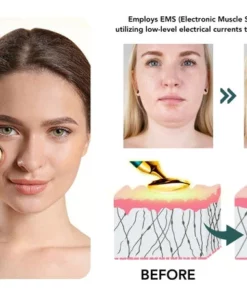 Oveallgo™ VorSculpt V-Face Contouring Device