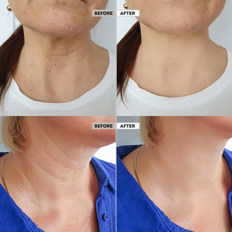 Seurico™ Skin Firm Jikin Magani