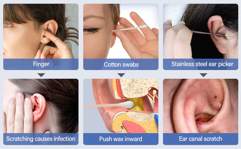 Seurico™ Exclusive Patents 1080P Ear Wax Removal Camera