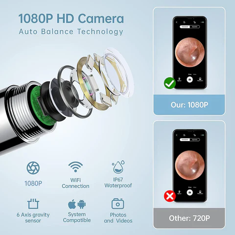 Seurico™ Exclusive Patents 1080P Ear Wax Removal Camera