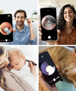 Seurico™ Exclusive Patents 1080P Ear Wax Removal Camera