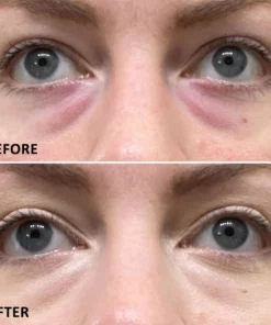 Seurico™ Eyelighter Concentrate Eye Serum