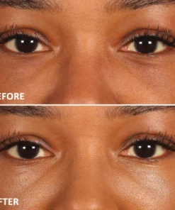 Seurico™ Eyelighter Concentrate Eye Serum