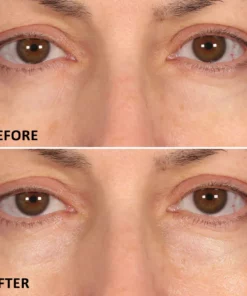 Seurico™ Eyelighter Concentrate Eye Serum