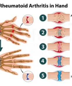 Seurico™ Neuseeland Bienengift Salbe