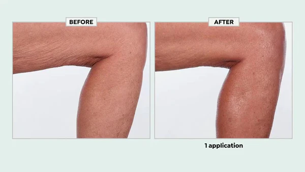 Patentoitu Exclusive Smooth Body Butter