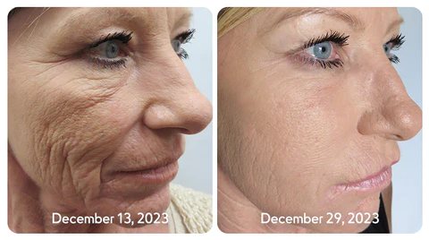 flysmus™ Natural Vitality Scorpion Venom Essence