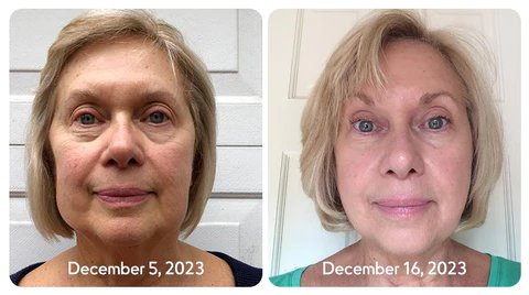 flysmus™ Natural Vitality Scorpion Venom Essence