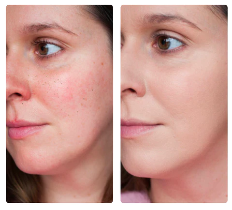 ATTDX Super Coverage Finish Foundation