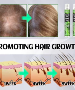 Awzlove™ FolliHerb Hair Growth Spray