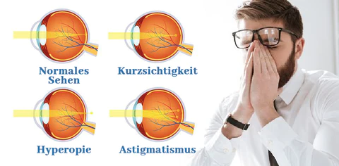 Ceoerty™ Kurzsichtigkeit Umkehr Augentropfen