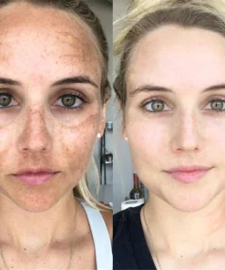 Ceoerty™ LumiSkin Peeling-Gesichtspeeling