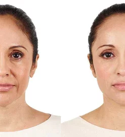 Ceoerty™ LumiSkin Peeling-Gesichtspeeling