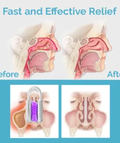 Ceoerty™ MucusRelief Nasal Cleansing Device