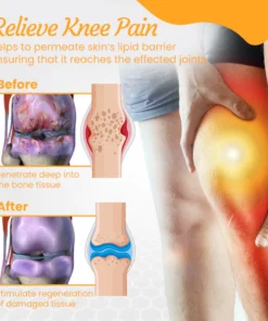 Ceoerty™ NZ Bee Venom Treatment Gel