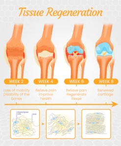 Ceoerty™ NZ Bee Venom Treatment Gel