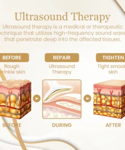 Ceoerty™ RevitaSculpt Ultrasonic Facelift Device