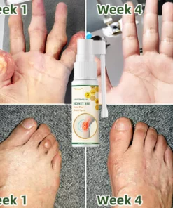 Cvreoz™ Bee Venom Pain and Bone Healing Spray